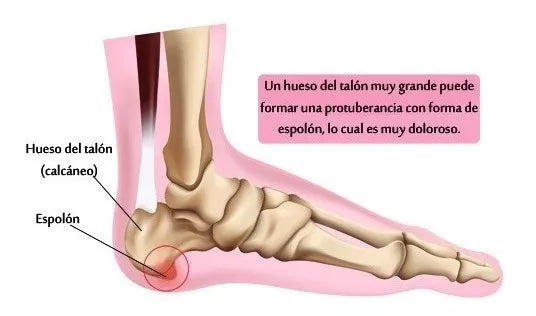 Plantillas Gel Ortopedicas Ajustables